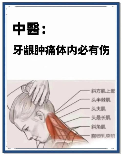 牙周炎穴位按摩治疗方法