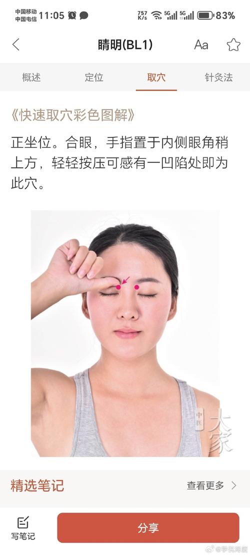 眼部神经痉挛 治疗穴位