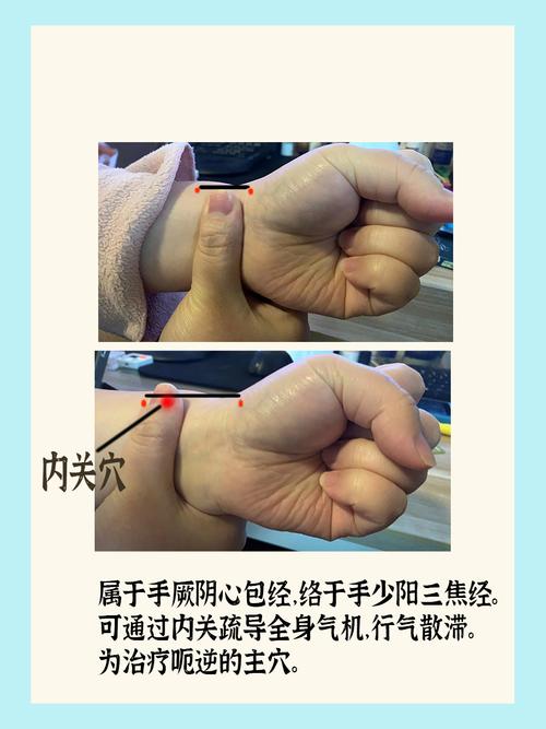 打嗝怎么快速解决 穴位