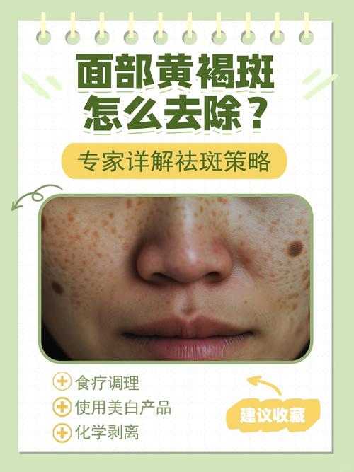 中医祛斑吴主任有用吗