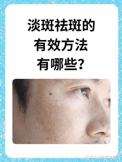 中医祛斑吴主任有用吗