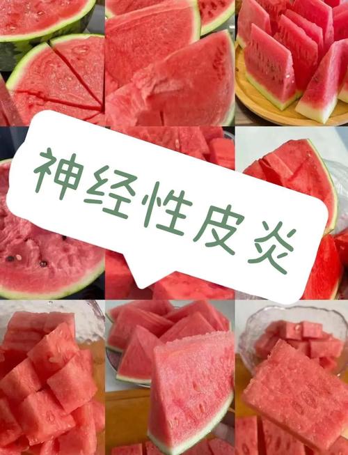 神经性皮炎饮食需要注意什么