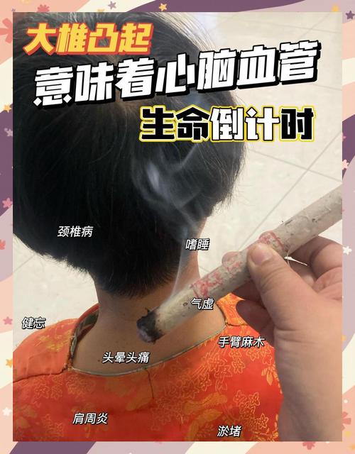 颈椎增生 骨刺艾灸穴位
