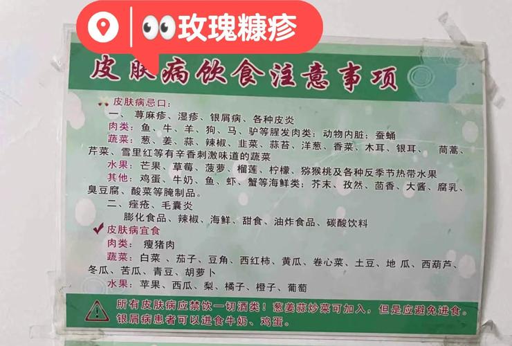 玫瑰糠疹怎么引起的饮食禁忌