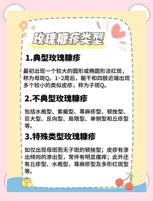 玫瑰糠疹怎么引起的饮食禁忌