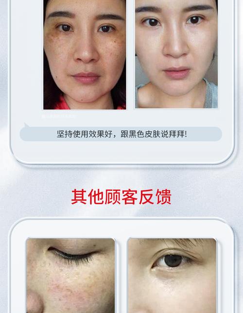 广东省中医院 祛斑露