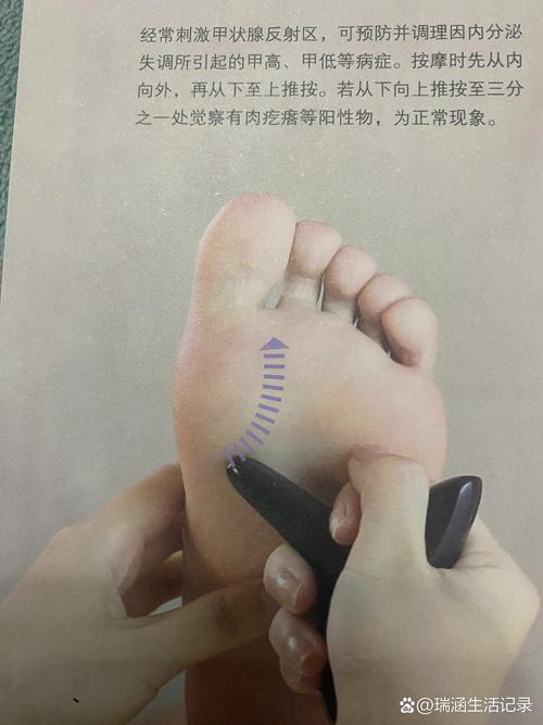 脚底穴位 甲状腺 酸痛