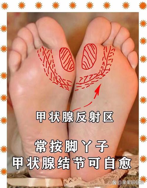 脚底穴位 甲状腺 酸痛