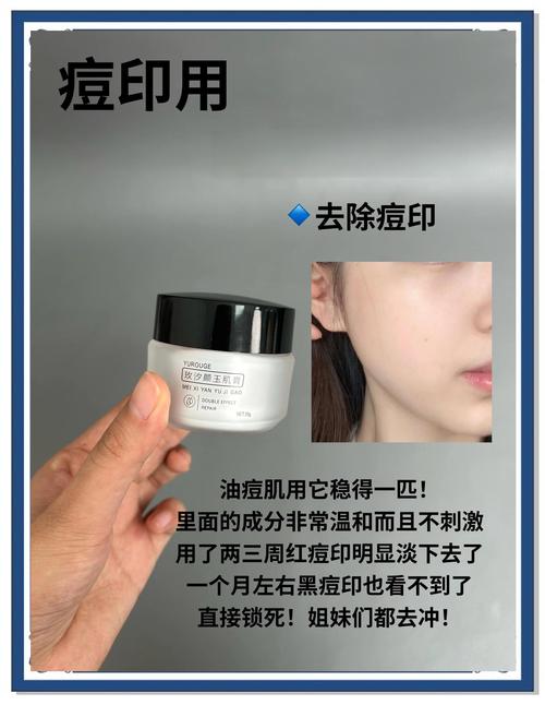 老中医祛痘霜有效果吗