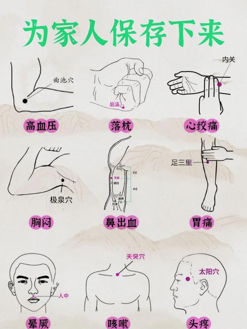 言语不清 针灸穴位