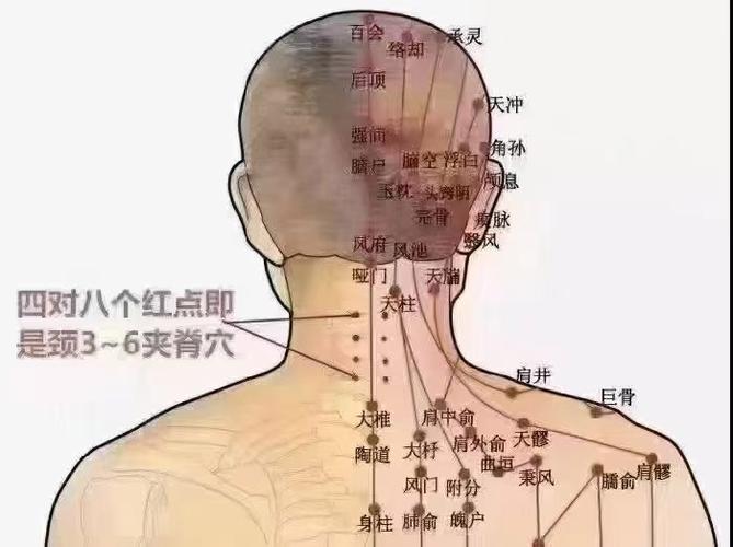 脖子后面酸痛 穴位