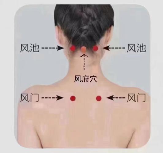 脖子后面酸痛 穴位