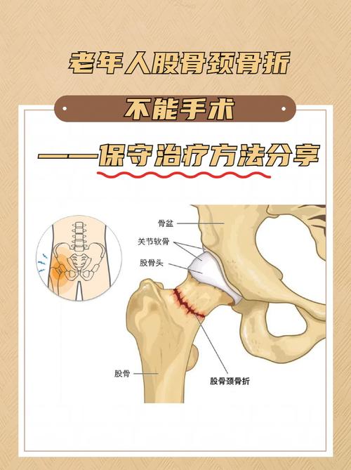 老中医谈股骨头的治疗
