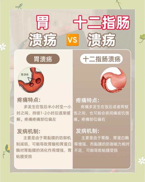 十二指肠球部溃疡饮食注意