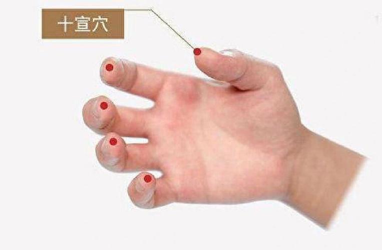 去火 手指 穴位 放血