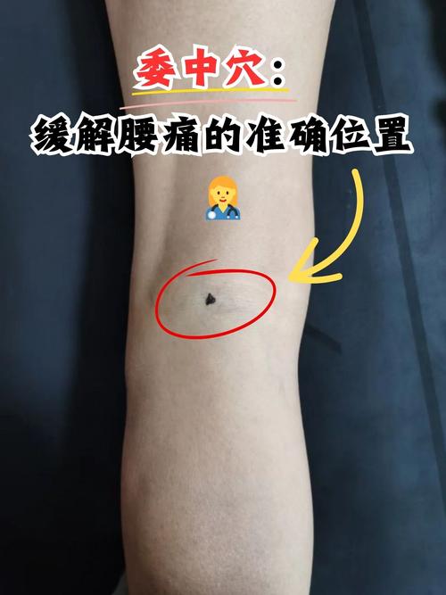 穴位 腰背委中求