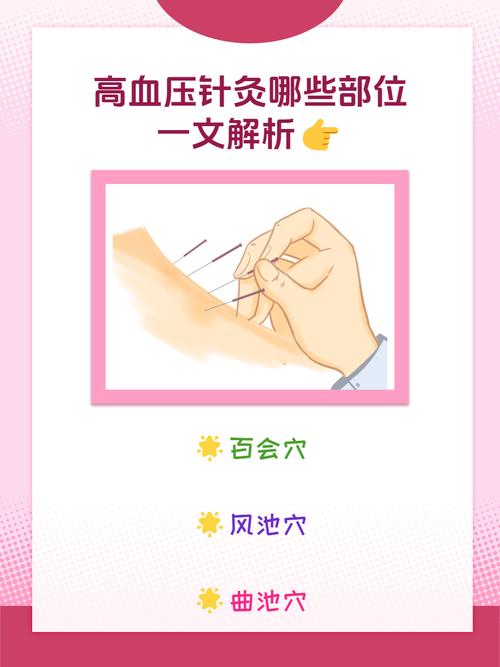 高血压穴位埋线穴位有那