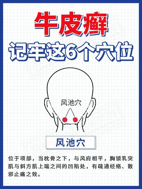 银屑病的穴位治疗穴位图