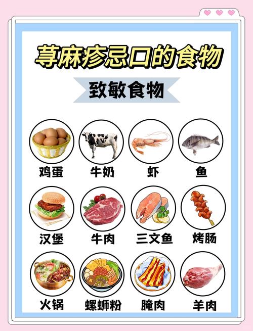 荨麻疹要注意什么饮食禁忌