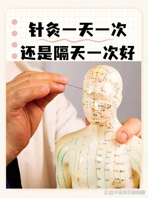 穴位埋线会不会破坏穴位