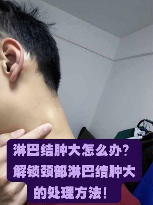 淋巴结肿大中医怎么治