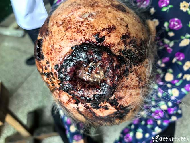 讷河市中医院医疗事故