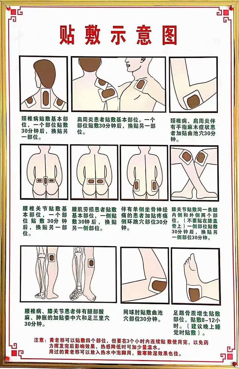 穴位敷贴穴位的选择原则