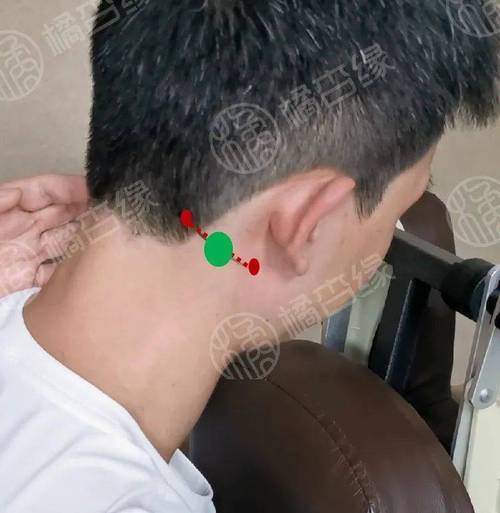 针灸耳后穴位是什么穴位