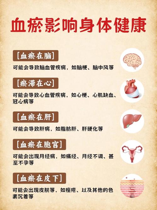 血瘀体质的穴位养生02