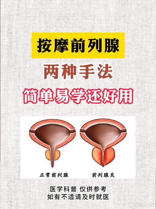 前列腺肥大按摩什么穴位