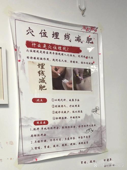 做完埋线双眼皮饮食注意