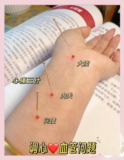 心脏不舒服按摩哪个穴位