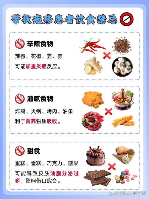 带状疱疹的饮食禁忌多久