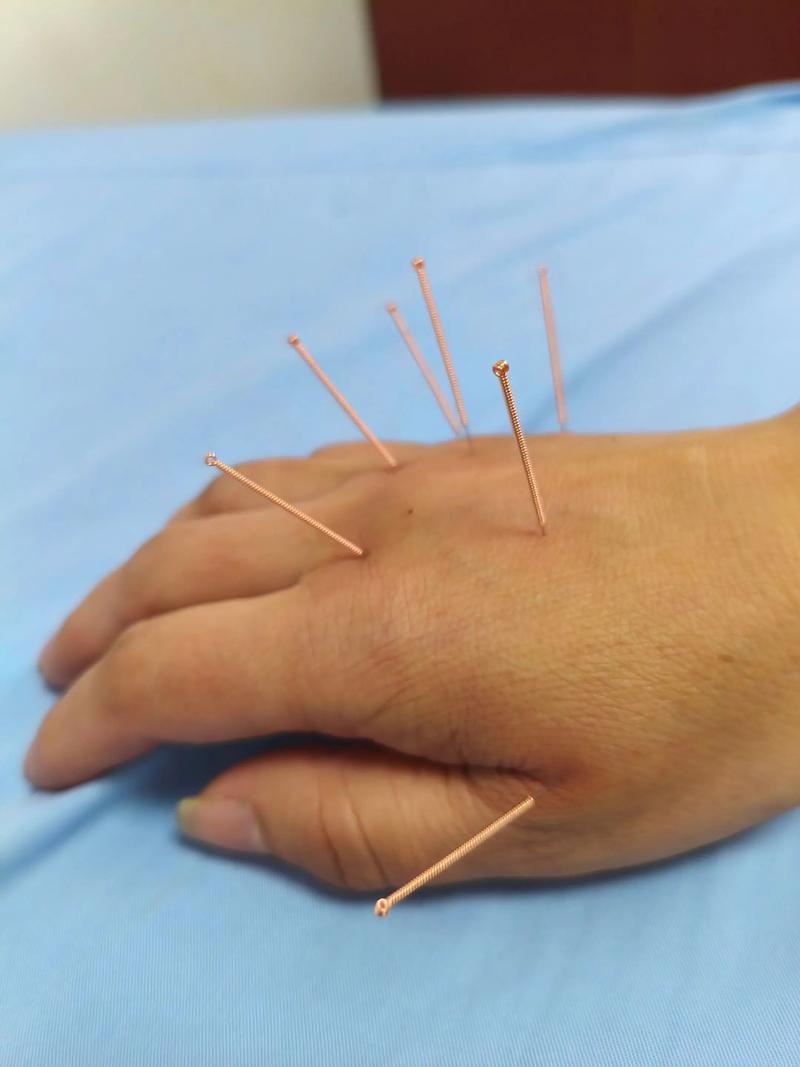 穴位注射维生素b 12