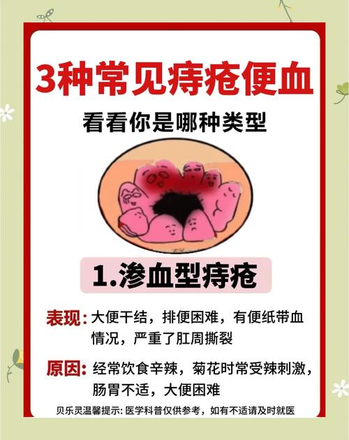 痔疮出血的饮食注意事项