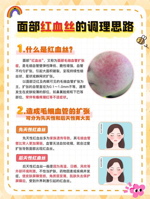 中医能调理好红血丝吗