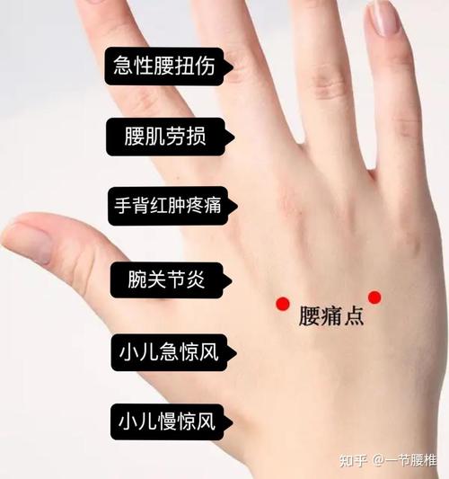 腰痛针灸特效穴位方法