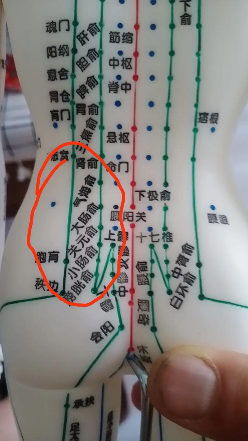 后背疼痛针灸什么穴位