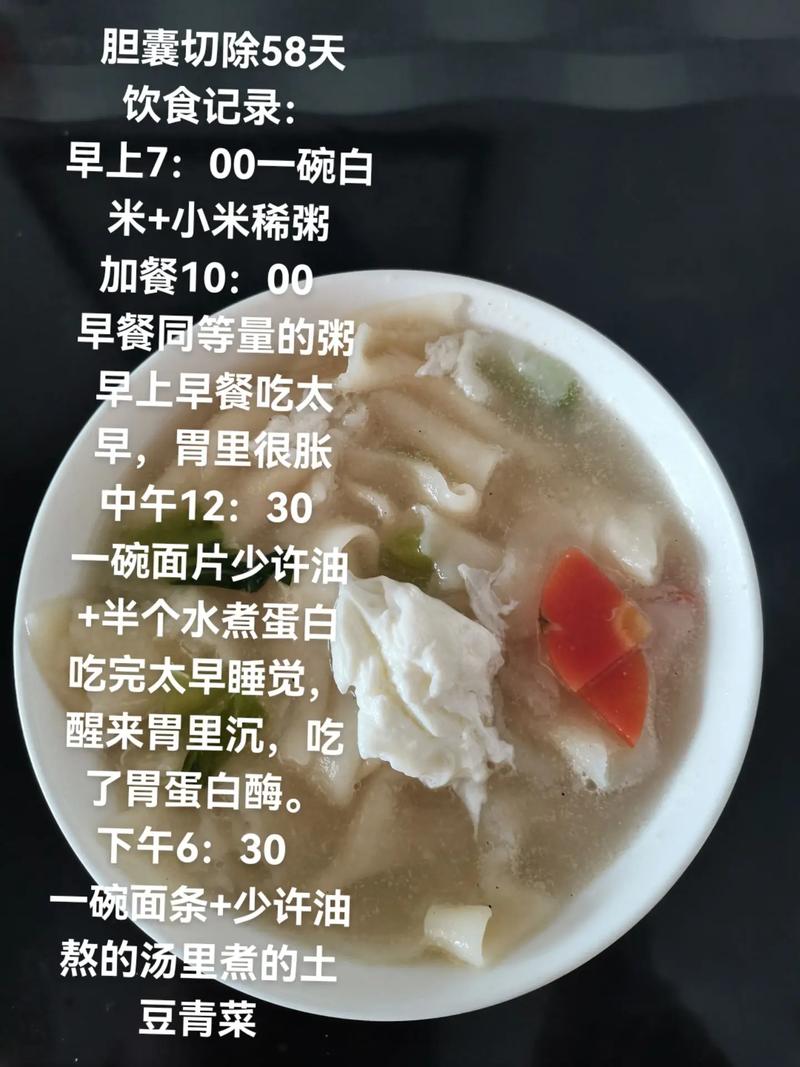 胆结石微创手术后的饮食