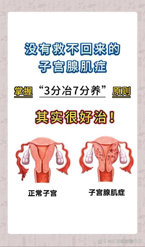 中医有好方法治腺肌症