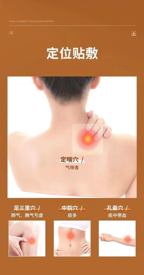 药物穴位外敷治疗咳嗽