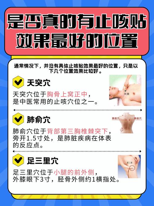 药物穴位外敷治疗咳嗽