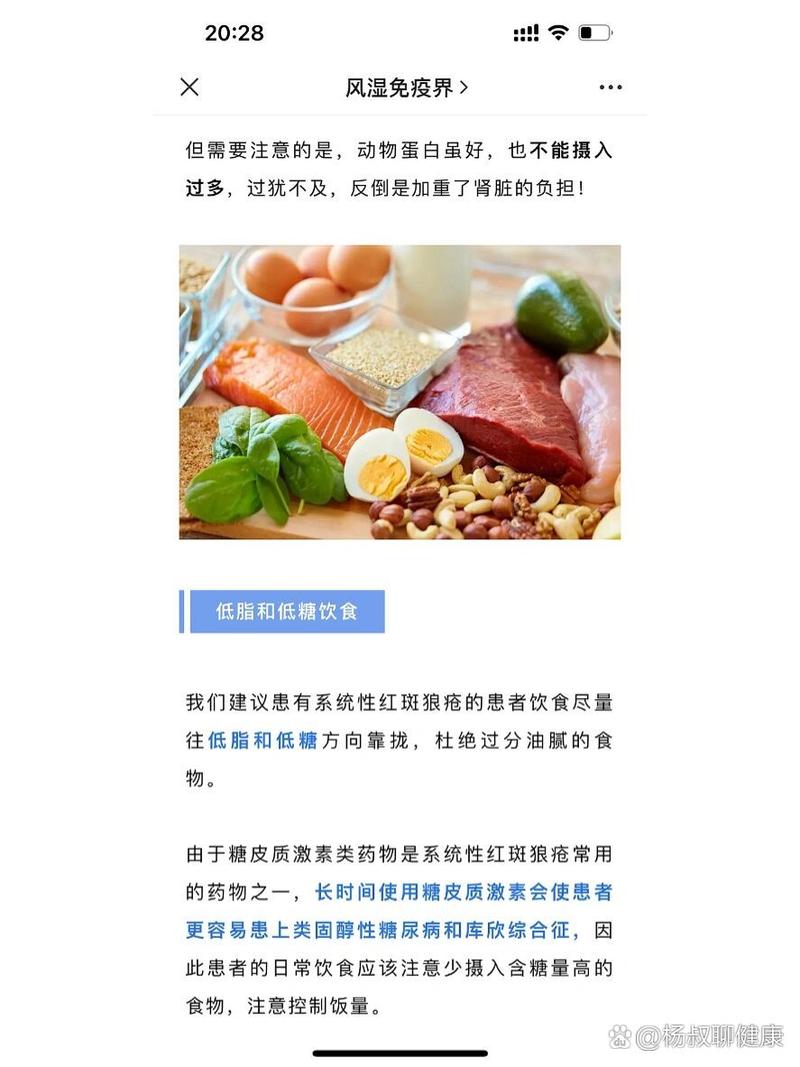 系统性红斑狼疮饮食注意