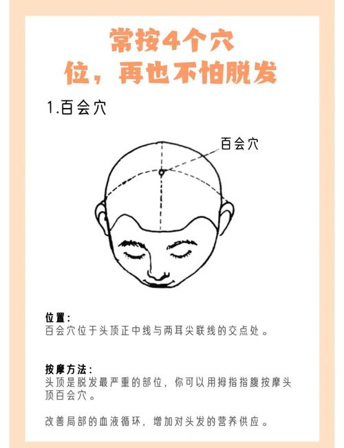 治疗脂溢性脱发的穴位