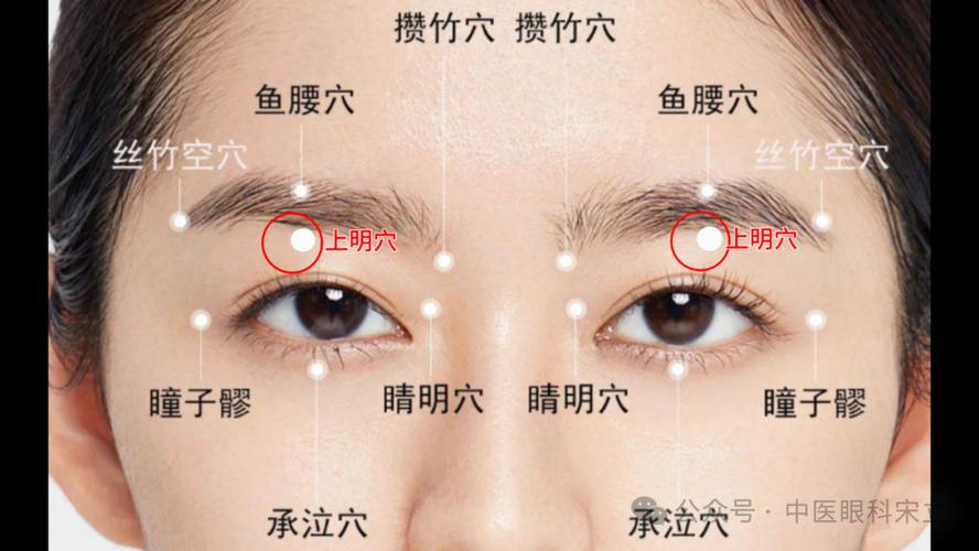 按摩穴位可以治疗近视