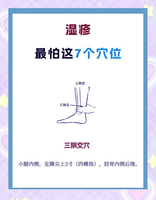 艾灸湿疹都做哪个穴位