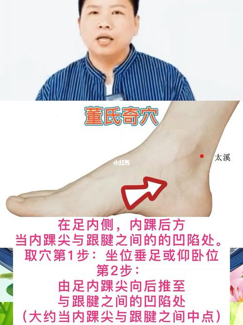 大脚拇指痛风针灸穴位