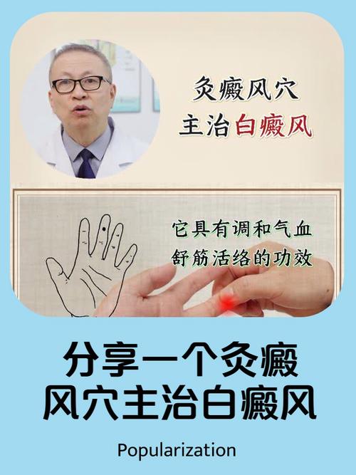 用艾灸疗法白癜风穴位