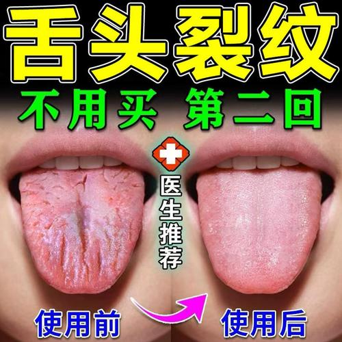 灼口综合症中医叫什么