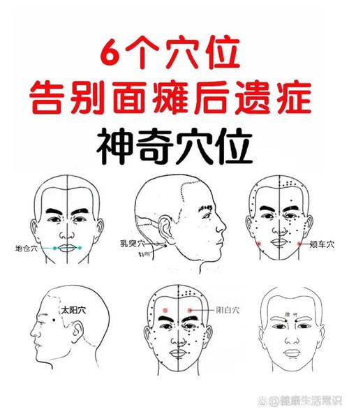 面部痉挛针灸哪些穴位